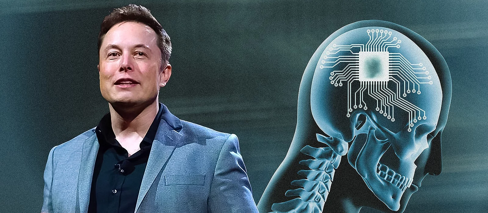 18 mēnešus pēc smadzeņu mikroshēmas implantācijas pirmais Elona Muska pacients, kurš izmanto Neuralink, dalās savā pieredzē.